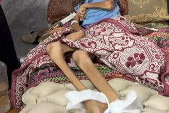 Disturbing images of starvation in Gaza