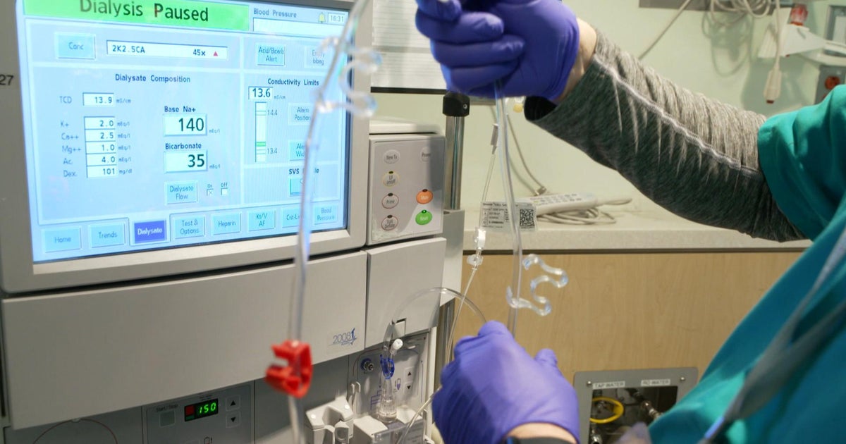 Lawmaker Queries Status of For-Profit Dialysis Industry Investigation