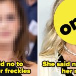 14 Celebs Told to Fix Their Distinctive Features, but Embraced Them