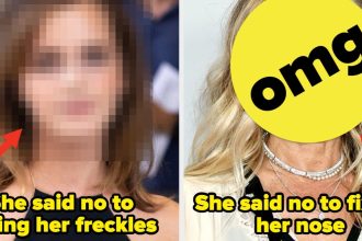 14 Celebs Told to Fix Their Distinctive Features, but Embraced Them